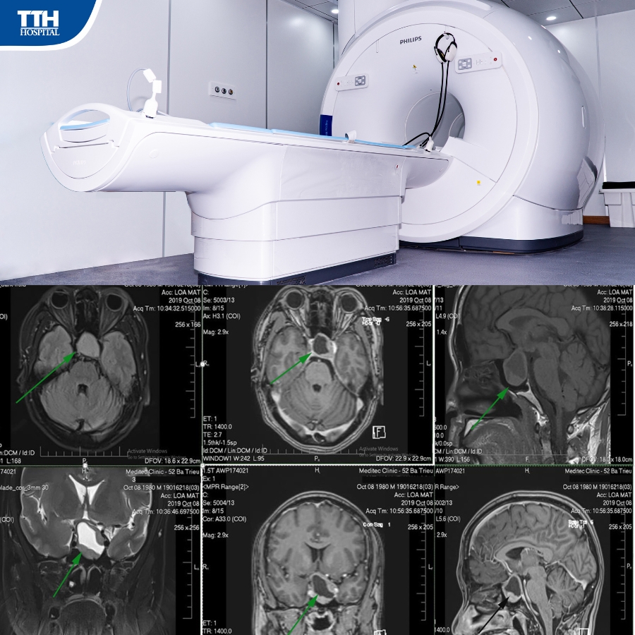 máy MRI