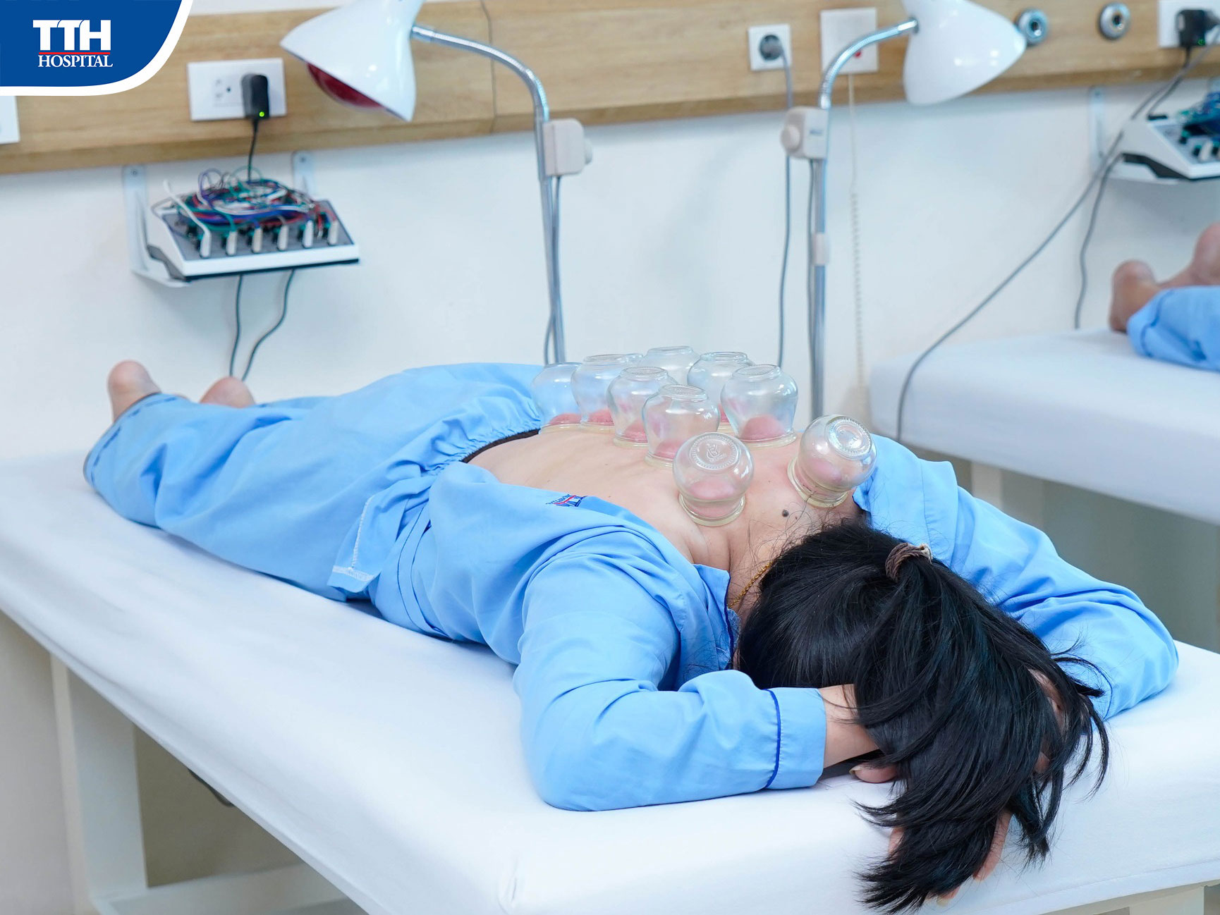 Các phương pháp giác hơi thường được áp dụng