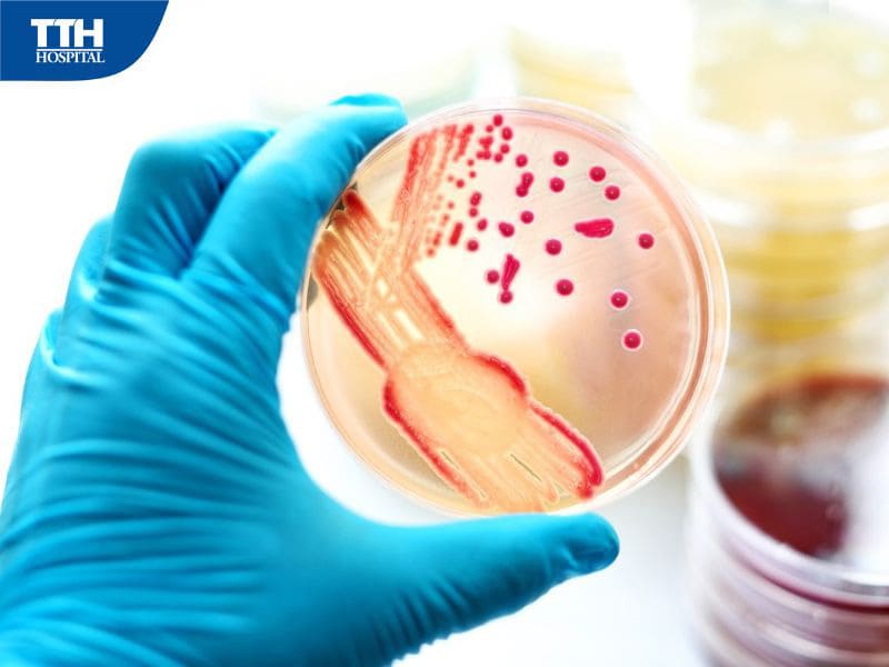 Cách chẩn đoán nhiễm trùng huyết