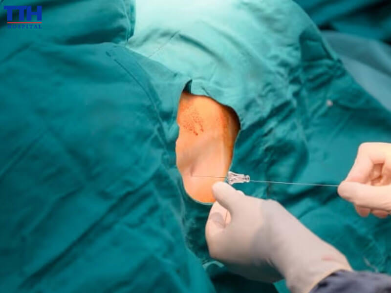 Giảm đau đa mô thức