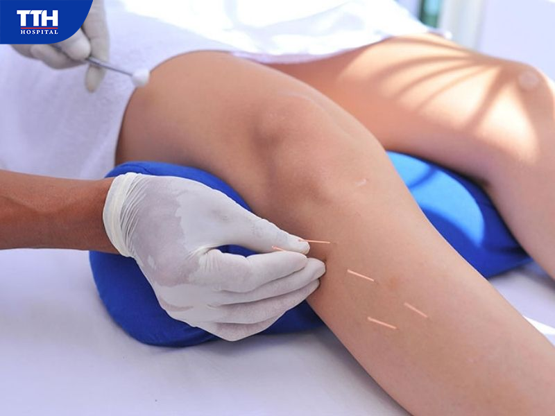 Kết hợp Y học cổ truyền và Phục hồi chức năng theo từng tình trạng