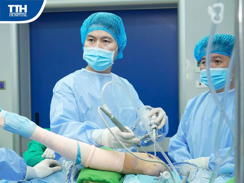 Khi nào cần phẫu thuật nối gân chóp xoay?