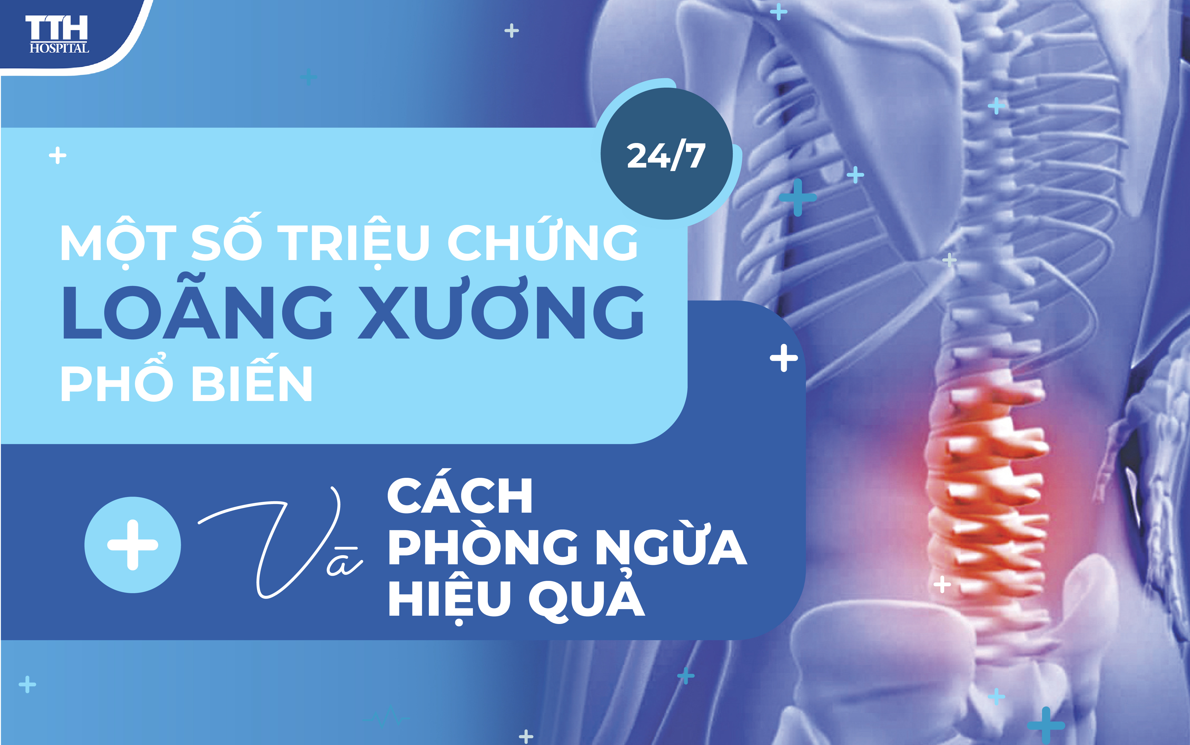 7. Các phương pháp điều trị bệnh loãng xương