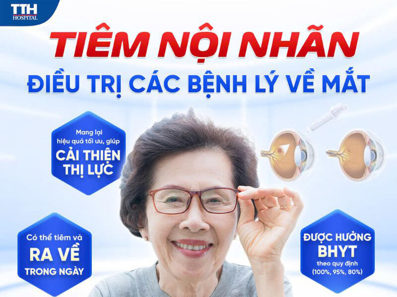 Lợi ích của tiêm nội nhãn