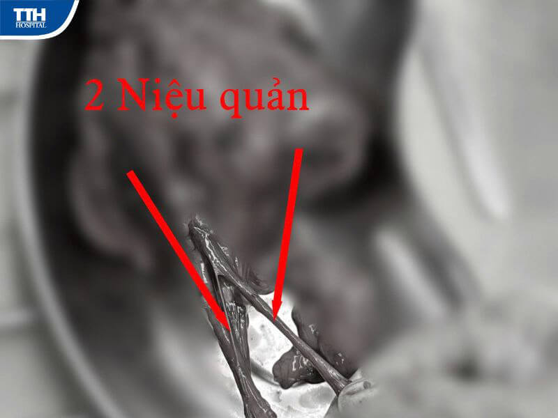 Tầm quan trọng của việc khám sức khỏe định kỳ
