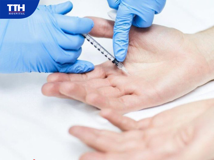 Tăng tiết mồ hôi tay có thể điều trị bằng những phương pháp nào?