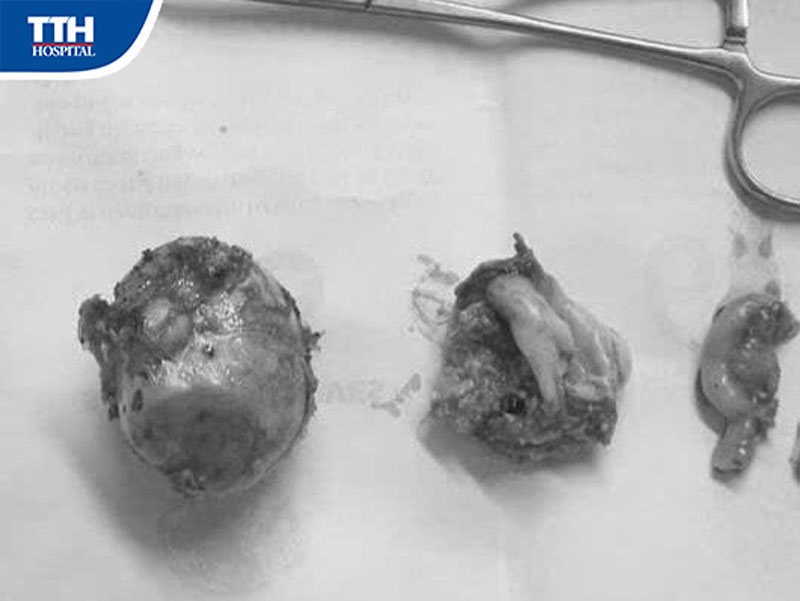 Tình trạng bệnh nhân