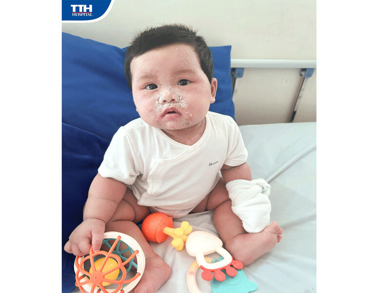 TRƯỜNG HỢP BỆNH NHI