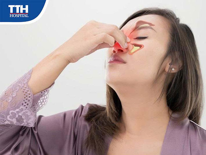 Viêm mũi xoang, bệnh lý phổ biến nhưng dễ bị chủ quan