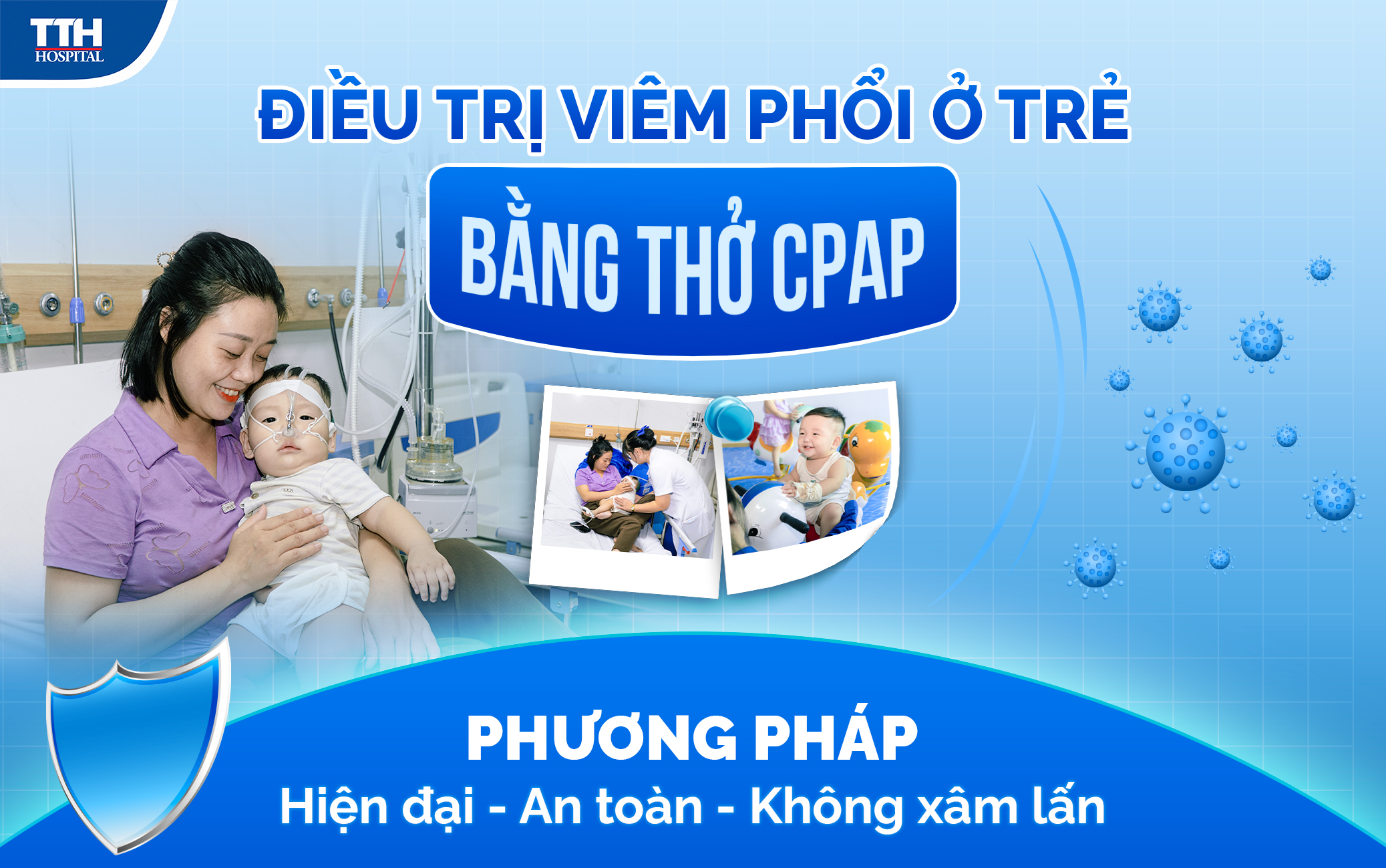 Ưu điể vượt trộ của phương pháp thở CPAP trong điều trị viêm phổi ở trẻ