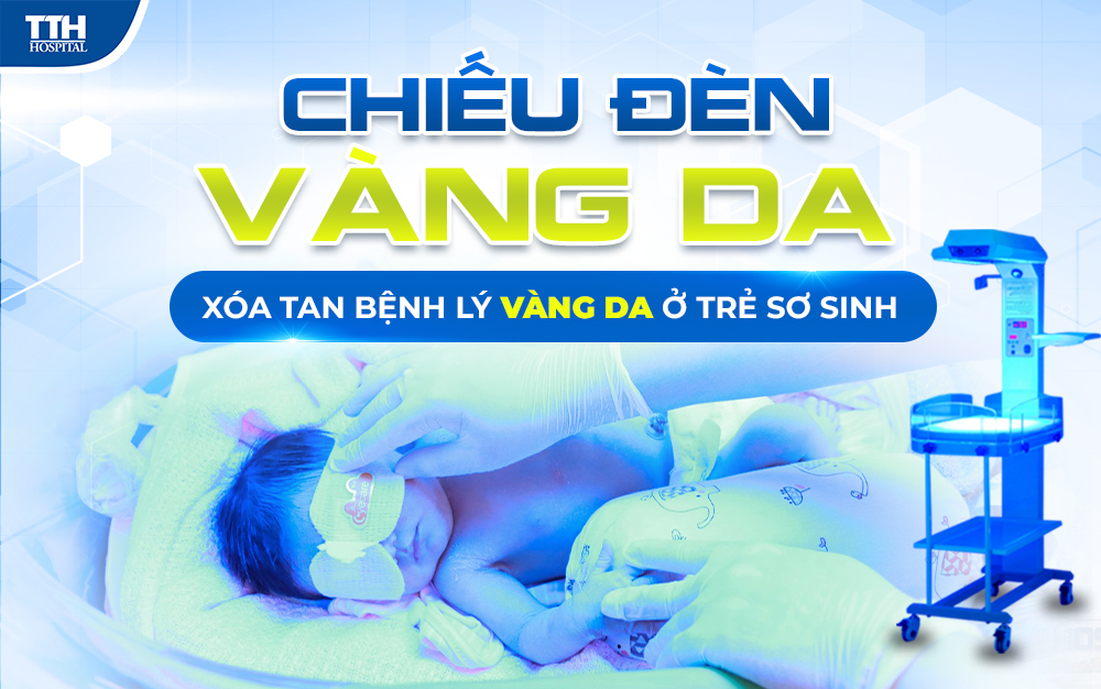 CHIẾU ĐÈN VÀNG DA - XÓA TAN BỆNH LÝ VÀNG DA Ở TRẺ SƠ SINH