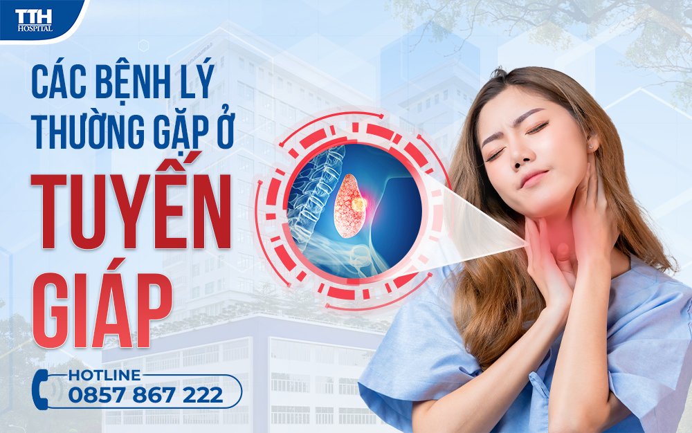 Các bệnh lý thường gặp ở tuyến giáp