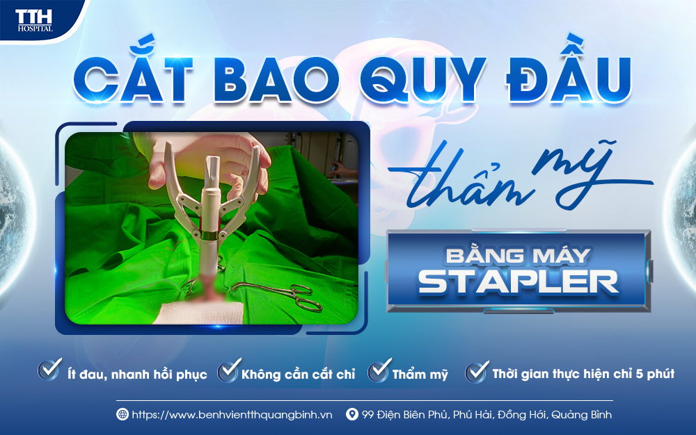 CẮT BAO QUY ĐẦU THẨM MỸ BẰNG MÁY STAPLER