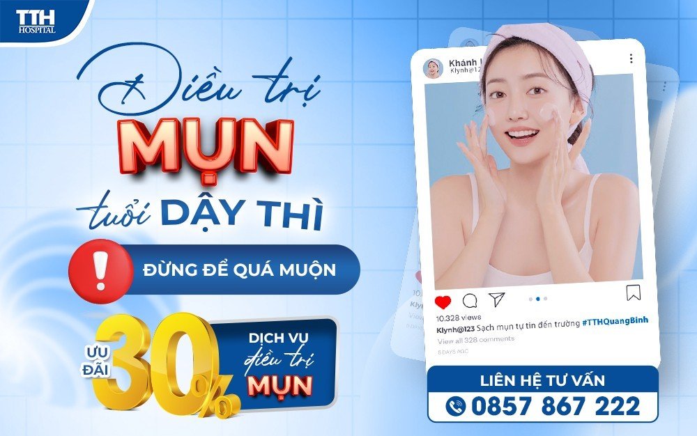 ĐIỀU TRỊ MỤN TUỔI DẬY THÌ - ĐỪNG ĐỂ QUÁ MUỘN