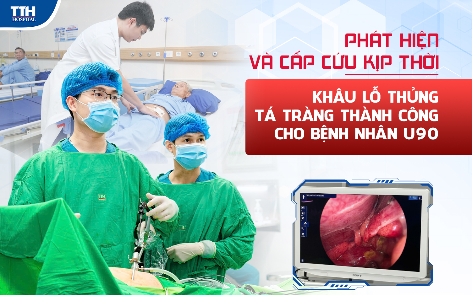 Phát hiện và cấp cứu kịp thời khâu lỗ thủng tá tràng thành công cho bệnh nhân U90