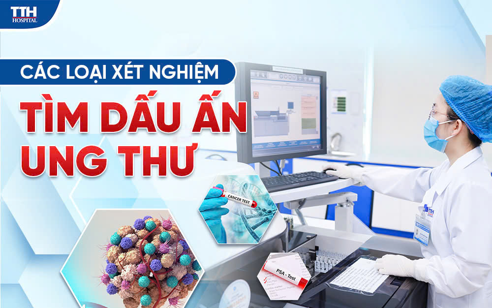 Xét nghiệm tìm dấu ấn ung thư có thể bạn chưa biết?