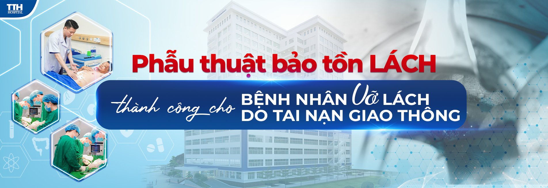 Phẫu thuật bảo tồn lách thành công cho bệnh nhân vỡ lách do tai nạn giao thông