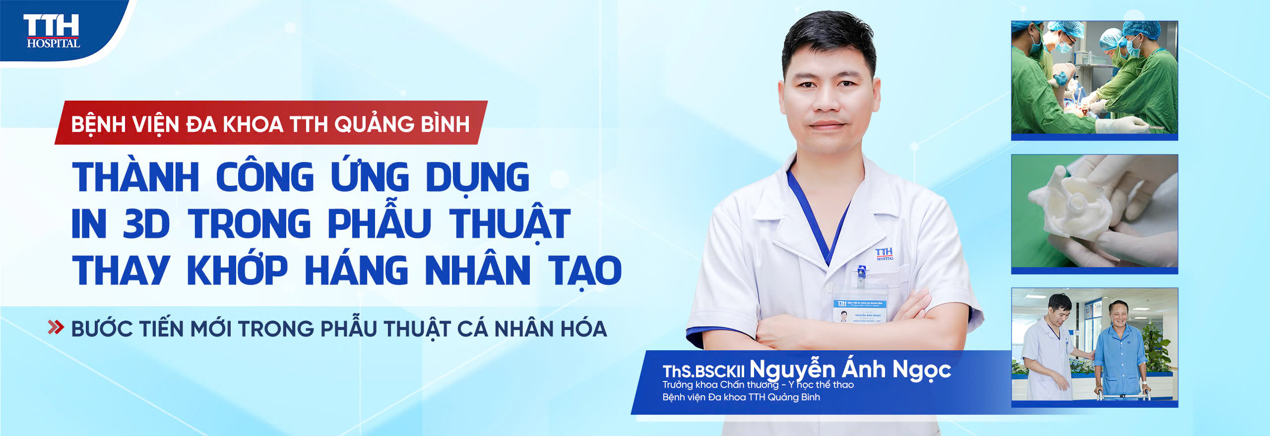 Bệnh viện Đa khoa TTH Quảng Bình thành công ứng dụng IN 3D trong phẫu thuật thay khớp háng nhân tạo - bước tiến mới trong phẫu thuật cá nhân hóa