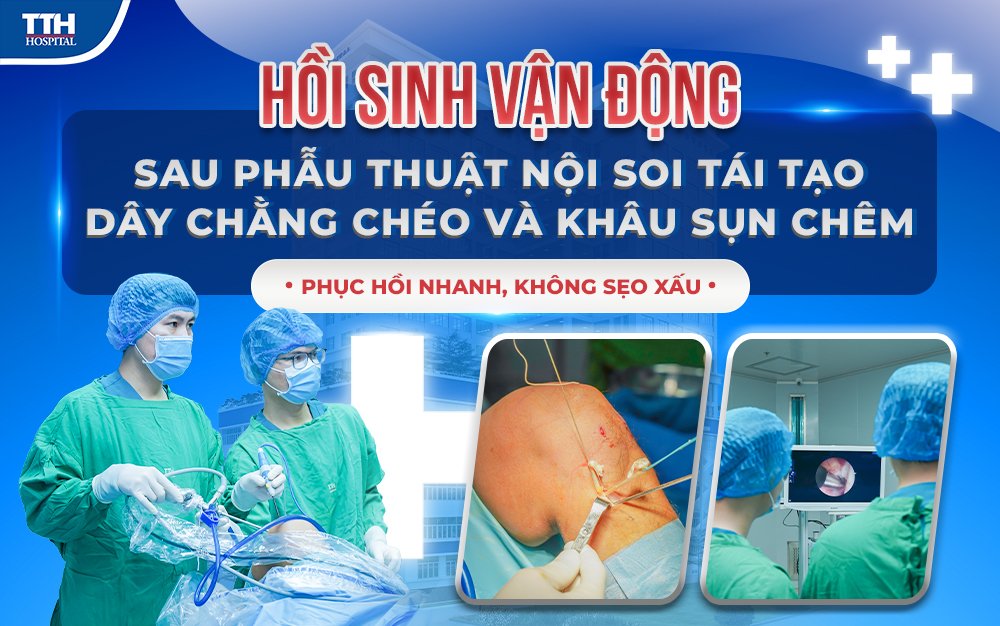 Hồi sinh vận động sau phẫu thuật nội soi tái tạo dây chằng chéo và khâu sụn chêm - Phục hồi nhanh, không sẹo xấu