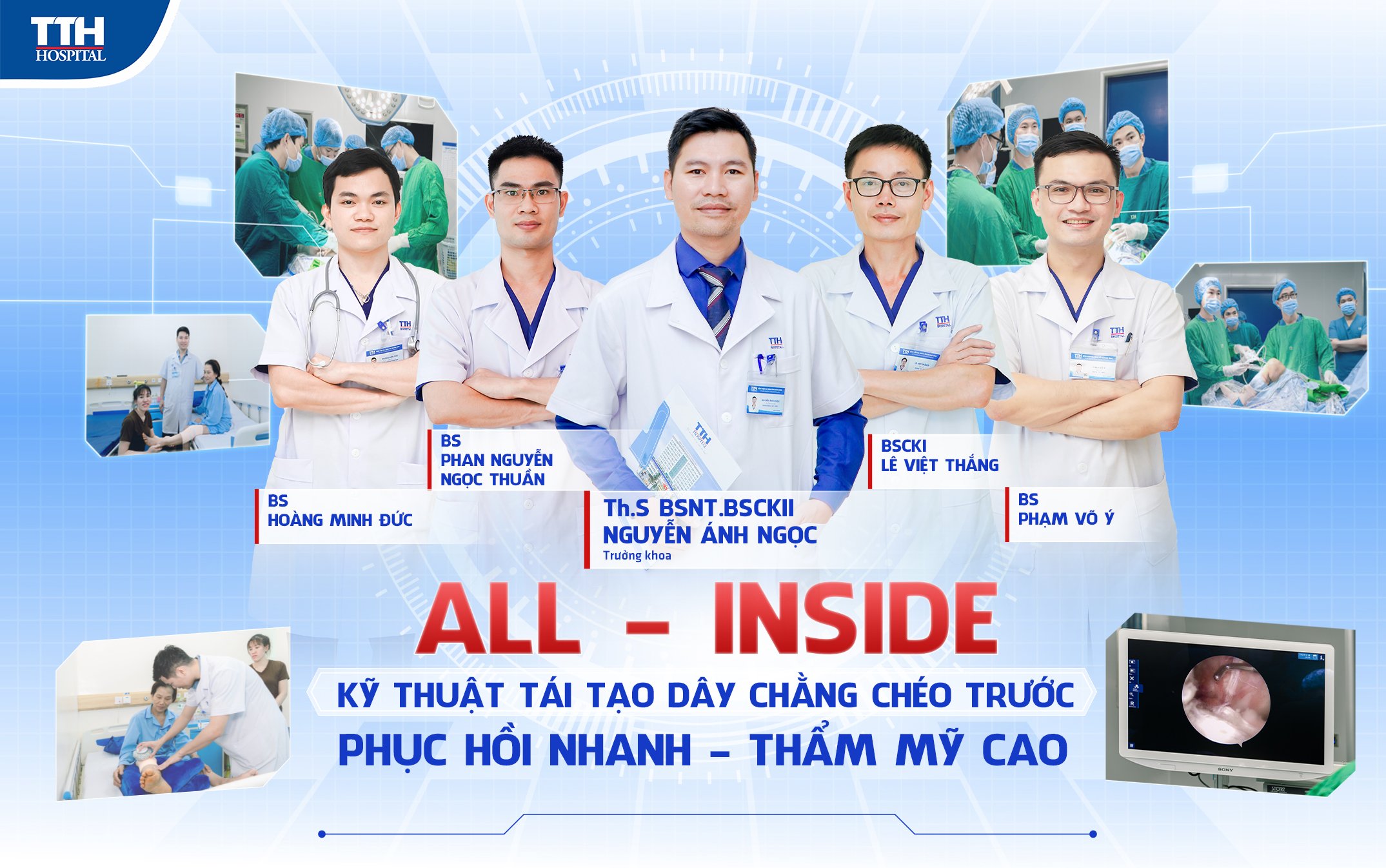 ALL INSIDE - Kỹ thuật tái tạo dây chằng chéo trước - phục hồi nhanh, thẩm mỹ cao