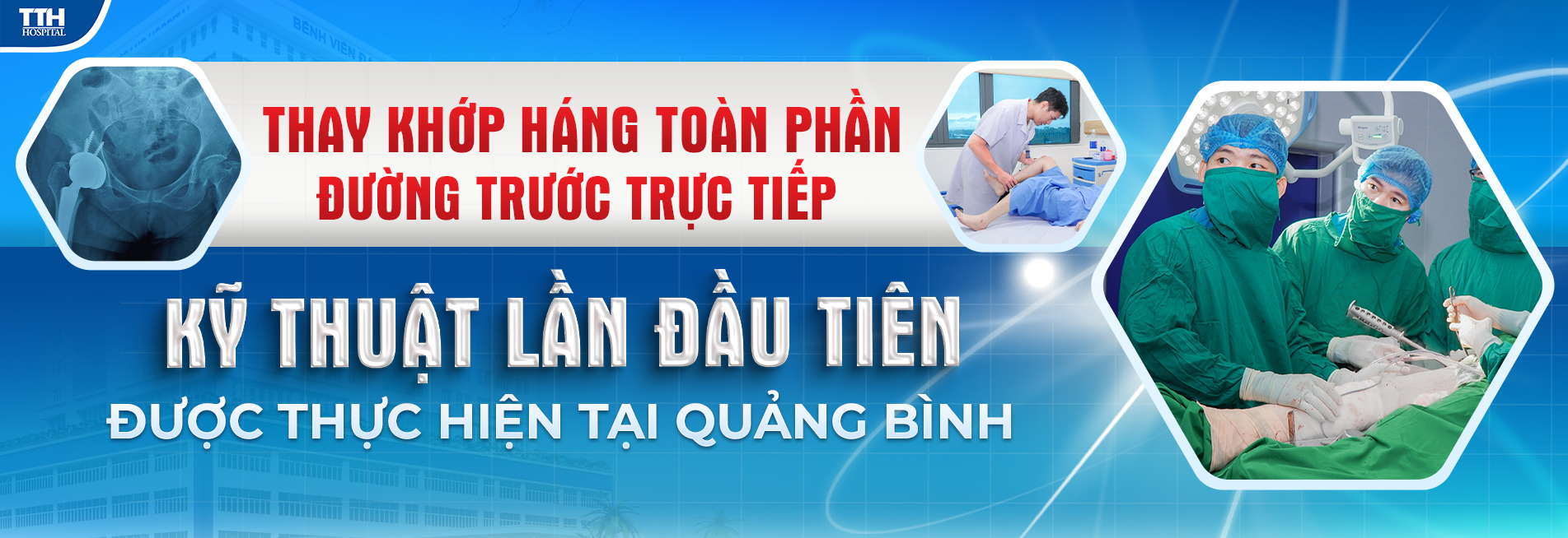 Thay khớp háng toàn phần đường trước trực tiếp - kỹ thuật lần đầu tiên được thực hiện tại Quảng Bình