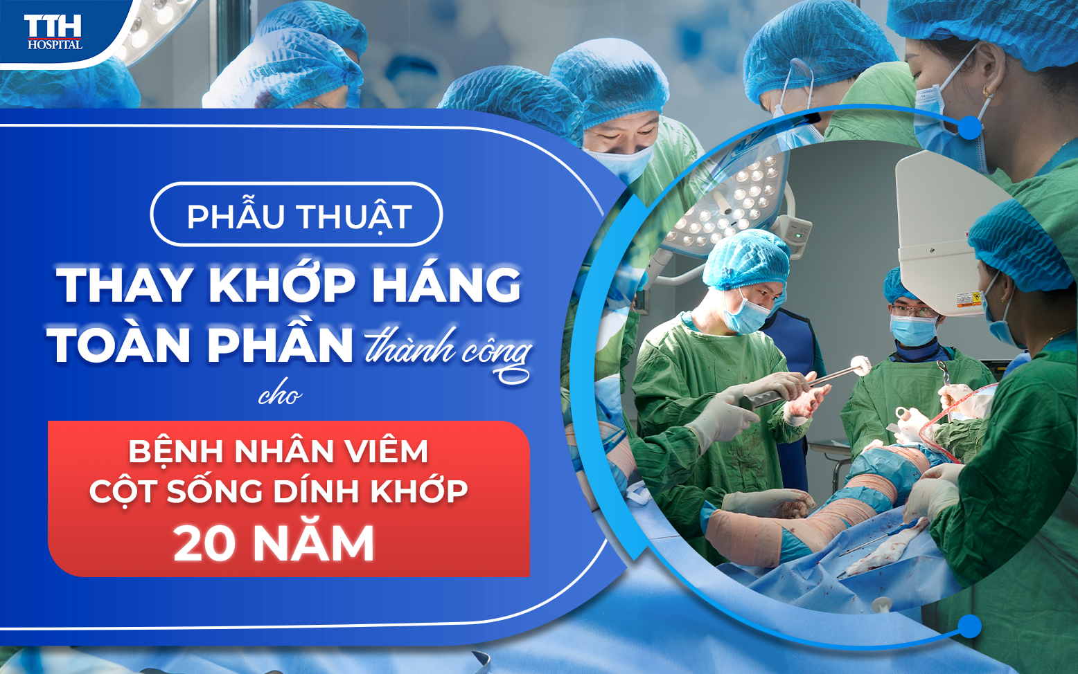 Phẫu thuật thay khớp háng toàn phần thành công cho bệnh nhân viêm cột sống dính khớp 20 năm