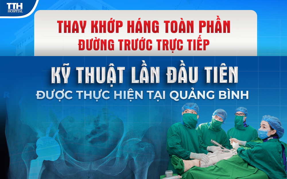 Thay khớp háng toàn phần đường trước trực tiếp - kỹ thuật lần đầu tiên được thực hiện tại Quảng Bình