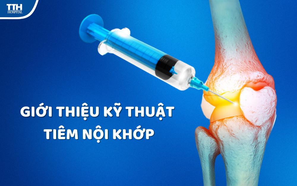 GIỚI THIỆU KỸ THUẬT TIÊM NỘI KHỚP TẠI BỆNH VIỆN ĐA KHOA TTH QUẢNG BÌNH