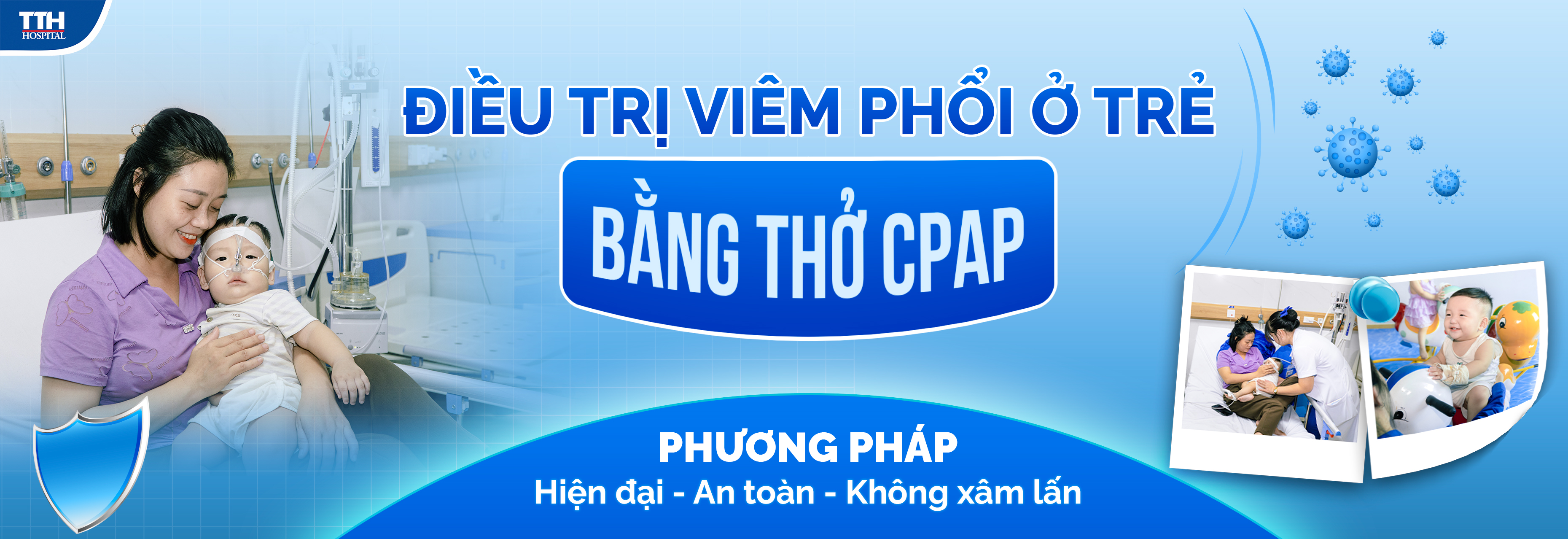 Ưu điểm vượt trội của phương pháp thở CPAP trong điều trị viêm phổi ở trẻ