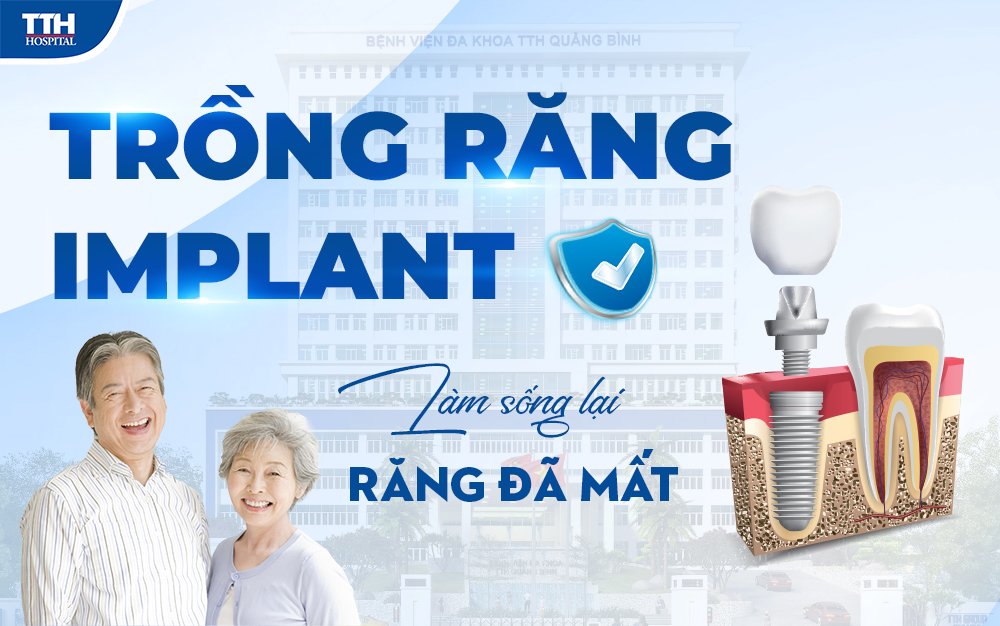 Trồng răng implant làm sống lại răng đã mất