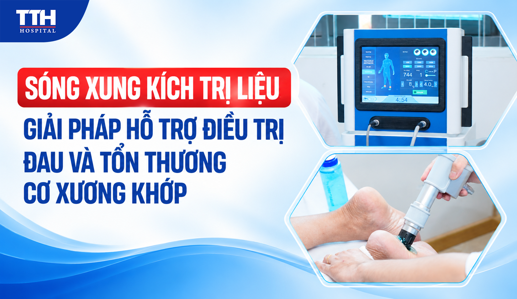 SÓNG XUNG KÍCH TRỊ LIỆU: GIẢI PHÁP HỖ TRỢ ĐIỀU TRỊ ĐAU VÀ TỔN THƯƠNG CƠ XƯƠNG KHỚP