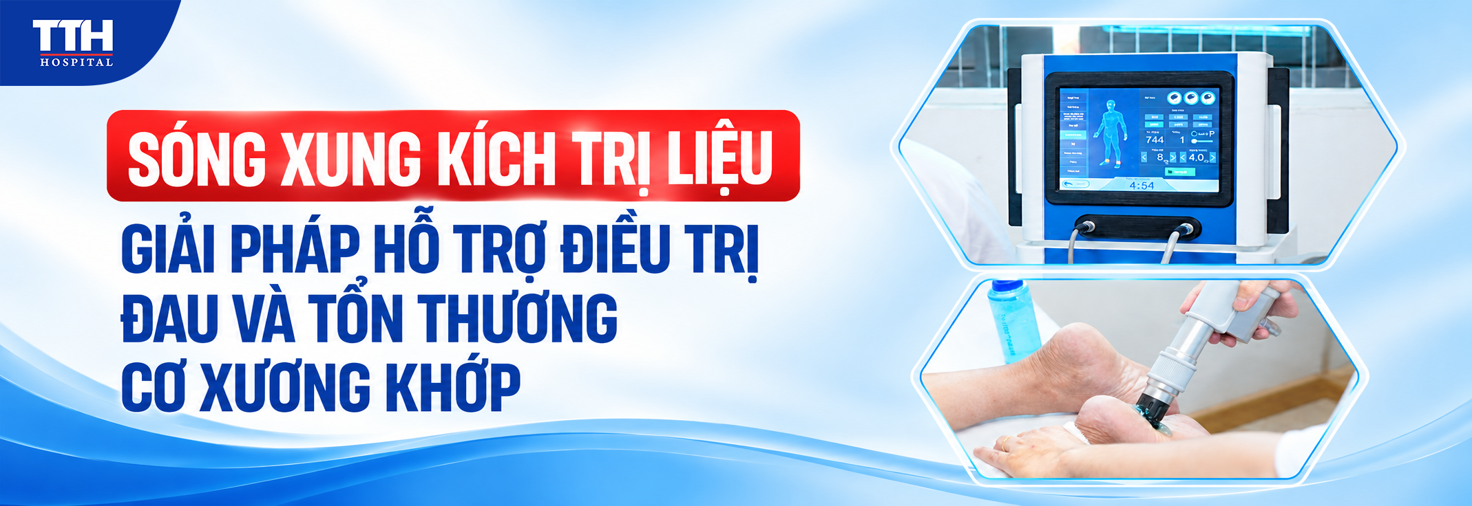 SÓNG XUNG KÍCH TRỊ LIỆU: GIẢI PHÁP HỖ TRỢ ĐIỀU TRỊ ĐAU VÀ TỔN THƯƠNG CƠ XƯƠNG KHỚP