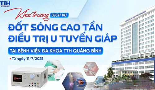 BVĐK TTH QUẢNG BÌNH TRIỂN KHAI KỸ THUẬT ĐỐT SÓNG CAO TẦN ĐIỀU TRỊ U TUYẾN GIÁP – TIỆN ÍCH MỚI, LỢI ÍCH LỚN CHO NGƯỜI DÂN ĐỊA PHƯƠNG