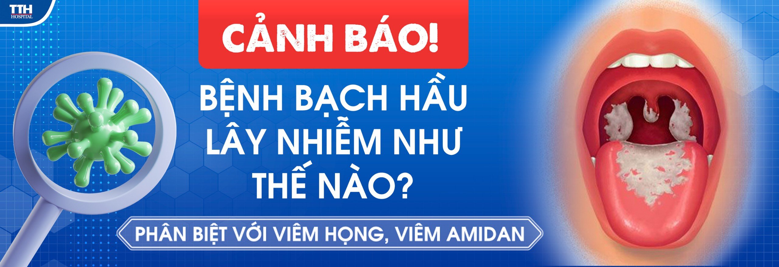 Bạch hầu là gì? bênh bạch hầu lây nhiễm như thế nào? - Bệnh viện đa ...