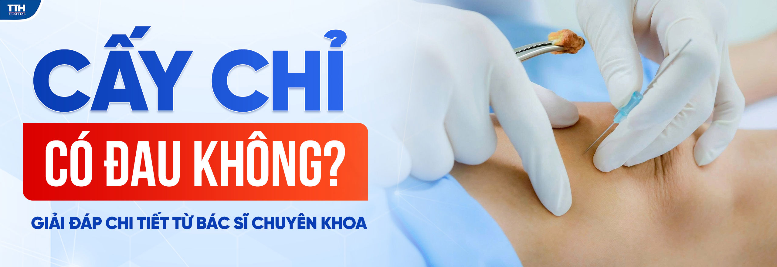 CẤY CHỈ CÓ ĐAU KHÔNG? GIẢI ĐÁP CHI TIẾT TỪ BÁC SĨ CHUYÊN KHOA