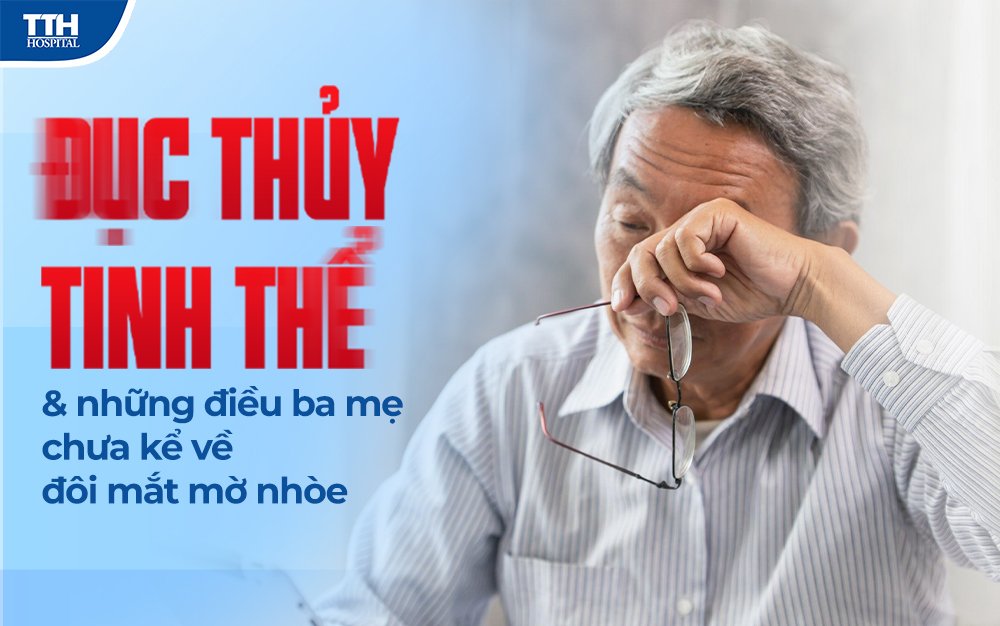 Đục thủy tinh thể và những điều ba mẹ chưa kể về đôi mắt mờ nhòe