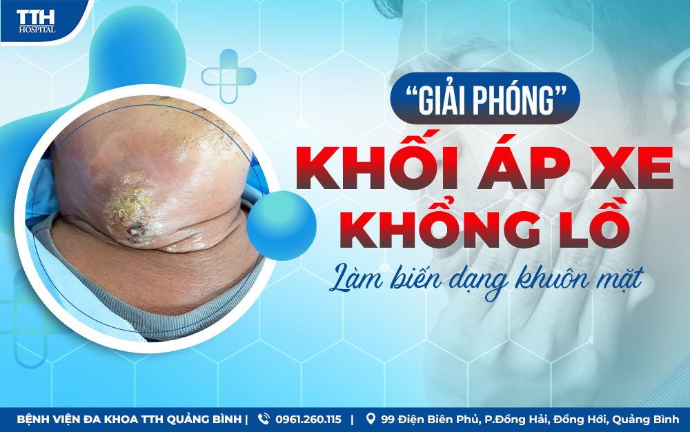 “GIẢI PHÓNG” KHỐI ÁP XE KHỔNG LỒ LÀM BIẾN DẠNG KHUÔN MẶT TẠI BỆNH VIỆN ĐA KHOA TTH QUẢNG BÌNH