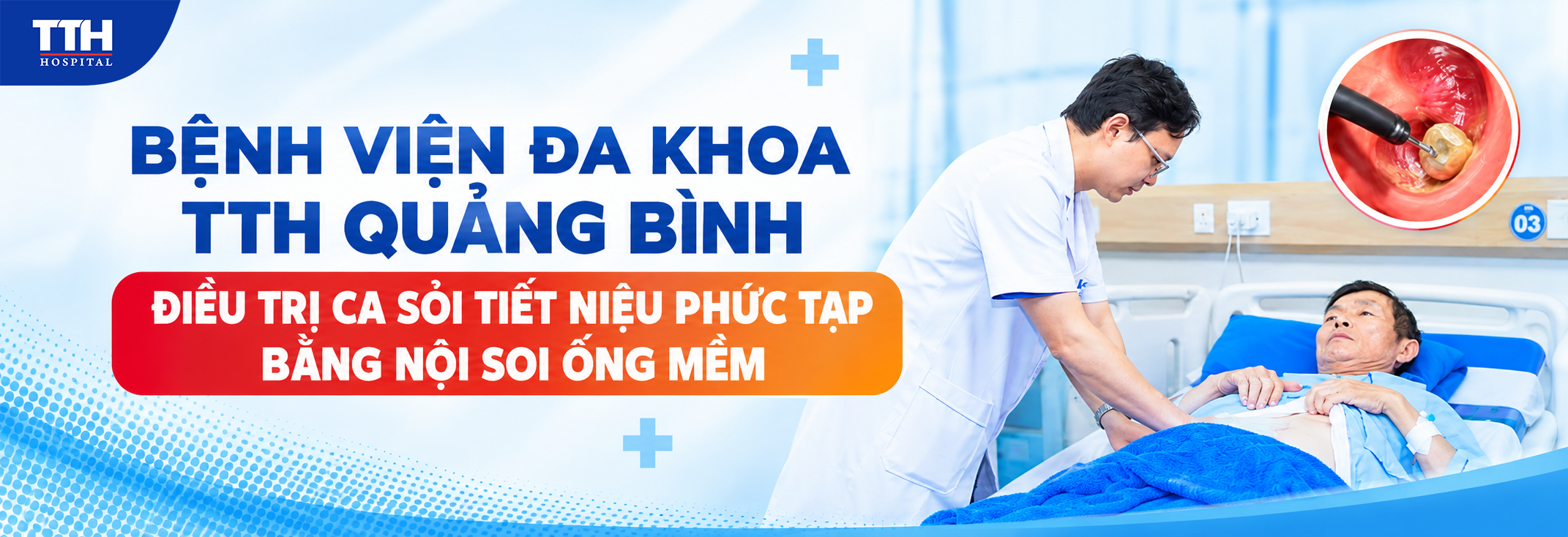 BỆNH VIỆN ĐA KHOA TTH QUẢNG BÌNH ĐIỀU TRỊ CA SỎI TIẾT NIỆU PHỨC TẠP BẰNG NỘI SOI ỐNG MỀM
