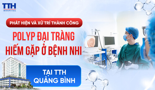 PHÁT HIỆN VÀ XỬ TRÍ THÀNH CÔNG POLYP ĐẠI TRÀNG HIẾM GẶP Ở BỆNH NHI TẠI TTH QUẢNG BÌNH