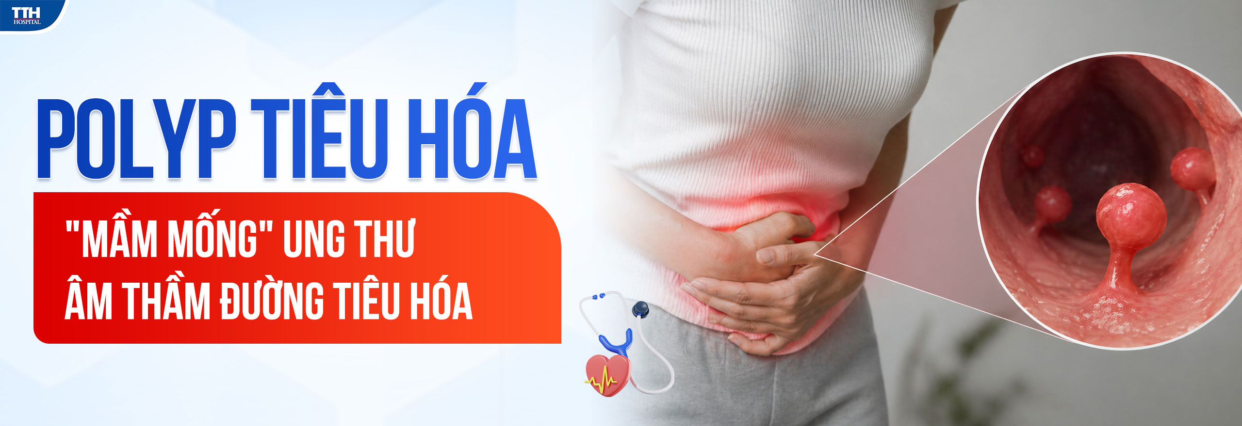 POLYP TIÊU HÓA - “MẦM MỐNG” UNG THƯ ÂM THẦM ĐƯỜNG TIÊU HÓA