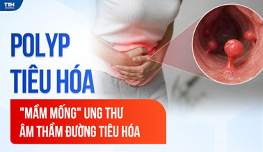 POLYP TIÊU HÓA - “MẦM MỐNG” UNG THƯ ÂM THẦM ĐƯỜNG TIÊU HÓA