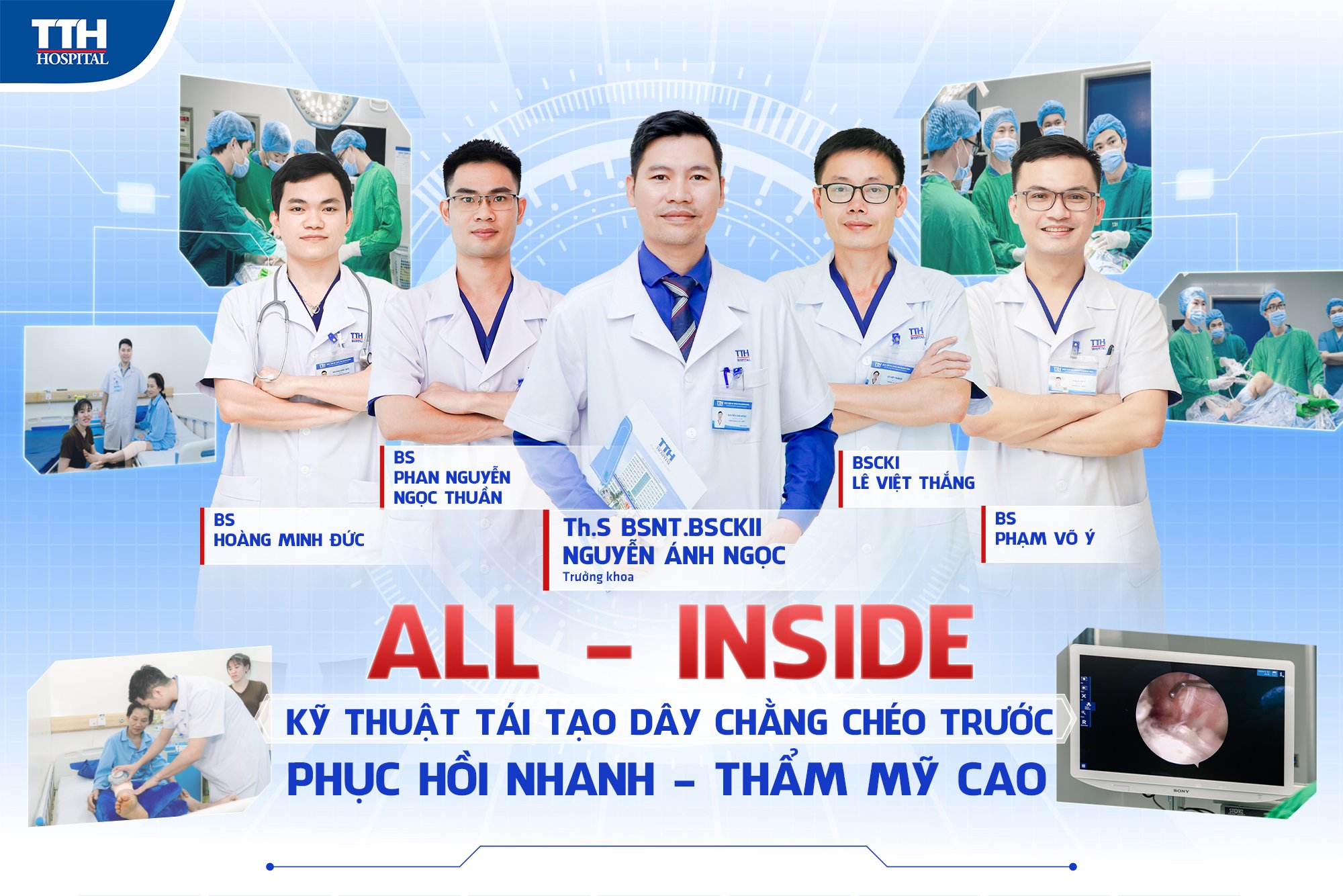 Phẫu thuật tái tạo dây chằng chéo trước- phục hồi nhanh tại bệnh viện TTH Quảng Bình