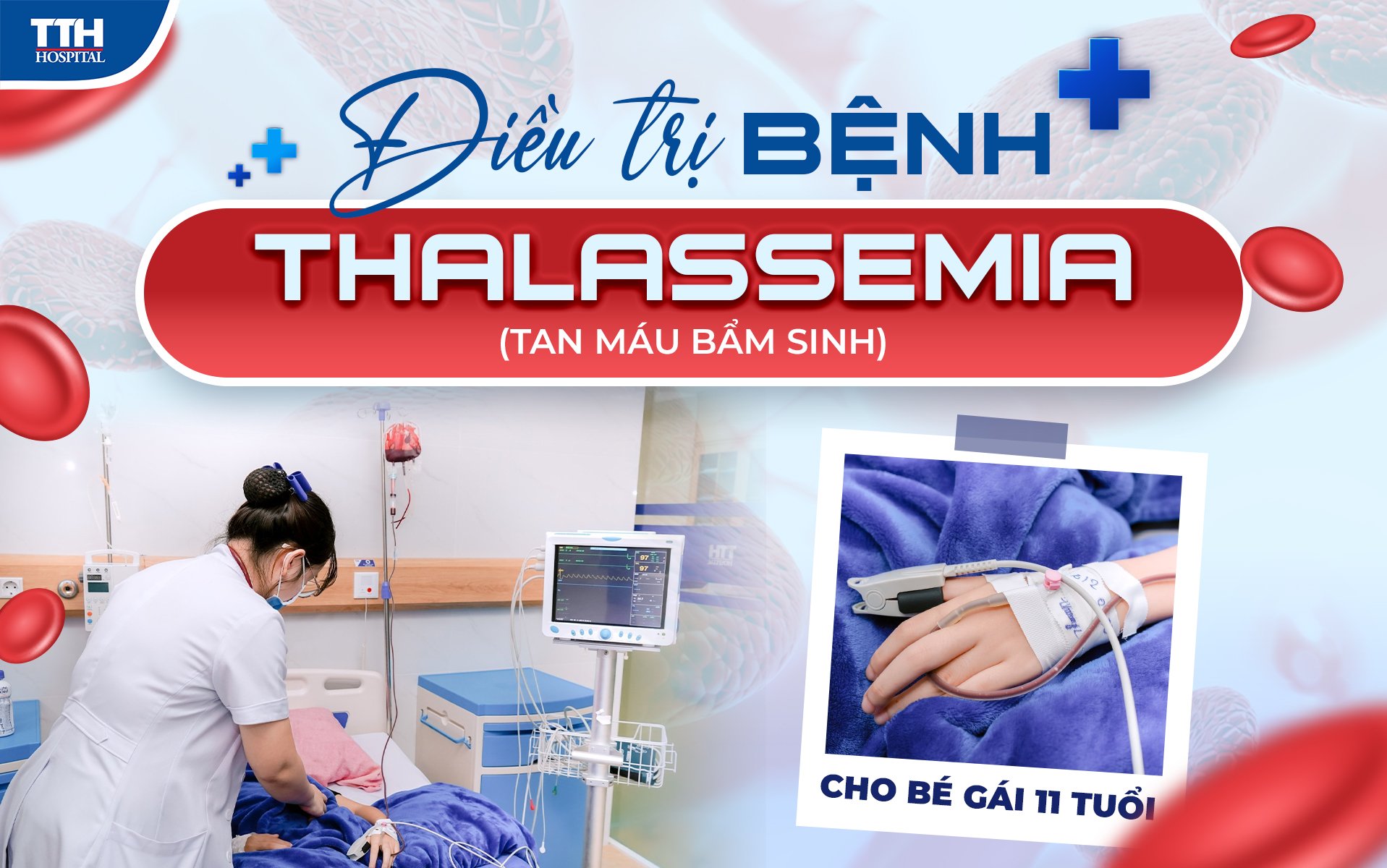 Điều trị bệnh Thalassemia - tan máu bẩn sinh cho bé giáu 11 tuổi