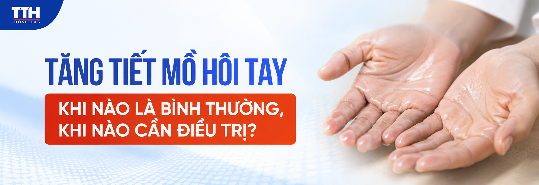 TĂNG TIẾT MỒ HÔI TAY: KHI NÀO LÀ BÌNH THƯỜNG, KHI NÀO CẦN ĐIỀU TRỊ?