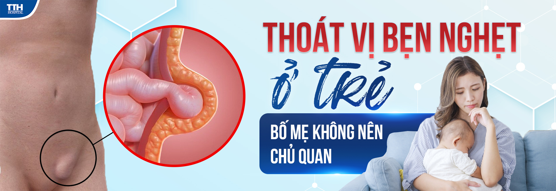 Thoát vị bẹn nghẹt ở trẻ - bố mẹ không nên chủ quan