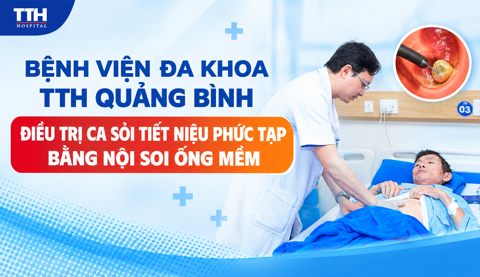 BỆNH VIỆN ĐA KHOA TTH QUẢNG BÌNH ĐIỀU TRỊ CA SỎI TIẾT NIỆU PHỨC TẠP BẰNG NỘI SOI ỐNG MỀM