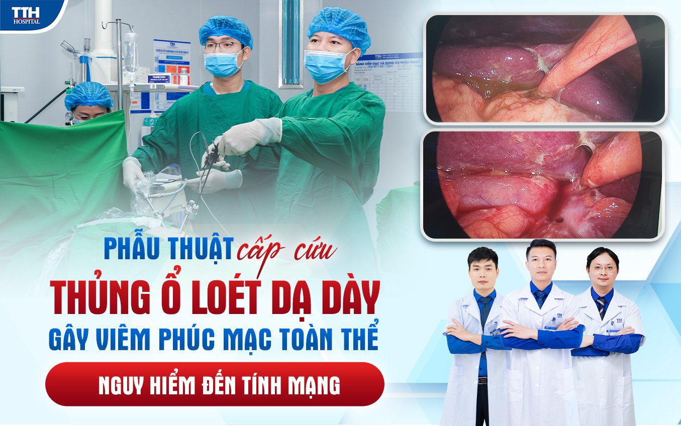 Phẫu thuật cấp cứu thủng ổ loét dạ dày gây viêm phúc mạc toàn thể nguy hiểm đến tính mạng