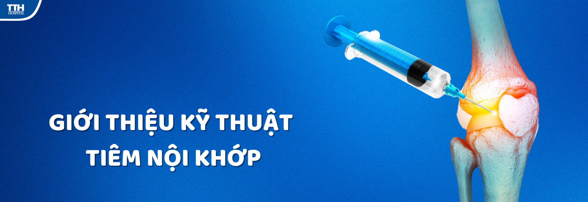 GIỚI THIỆU KỸ THUẬT TIÊM NỘI KHỚP TẠI BỆNH VIỆN ĐA KHOA TTH QUẢNG BÌNH