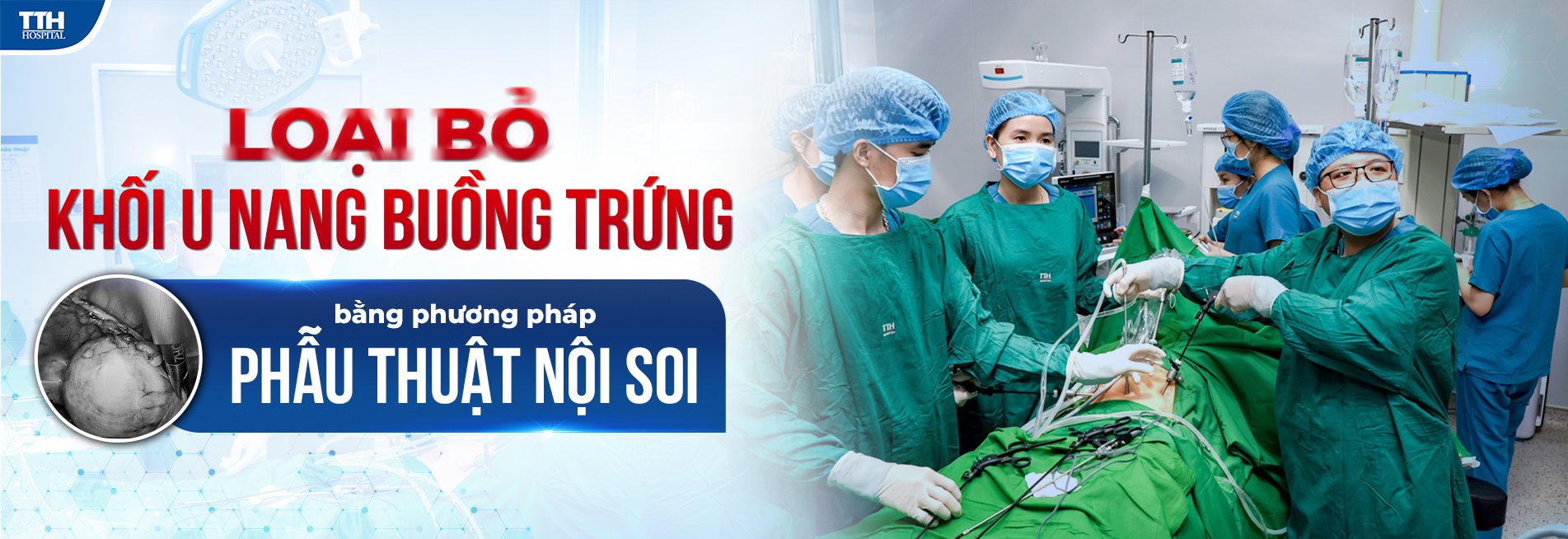 Loại bỏ khối u nang buồng trứng bằng phương pháp phẫu thuật nội soi