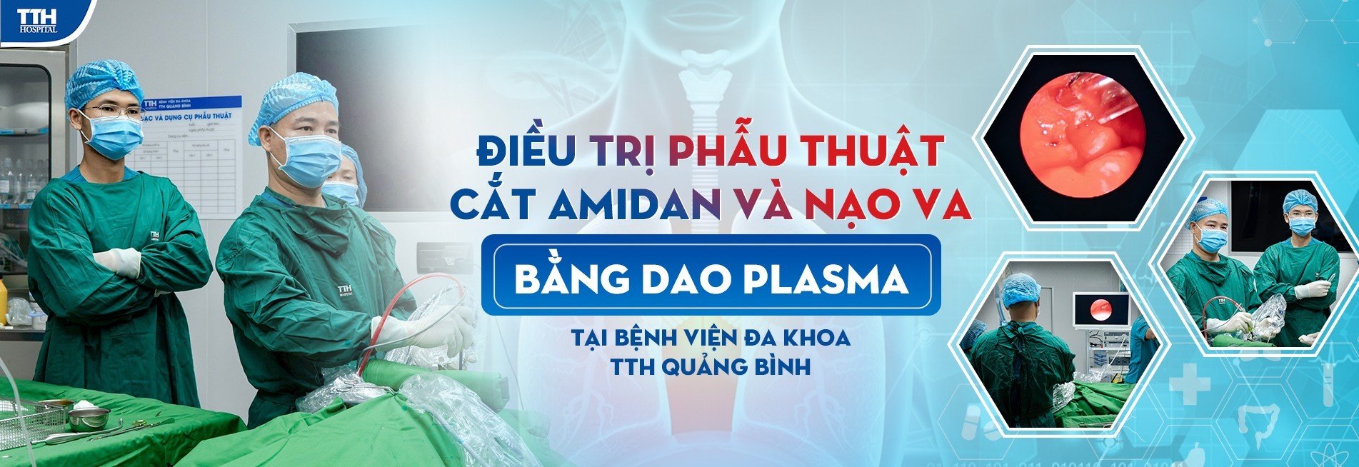 ĐIỀU TRỊ PHẪU THUẬT CẮT AMIDAN VÀ NẠO VA BẰNG DAO PLASMA CHO BỆNH NHÂN TẠI  BỆNH VIỆN ĐA KHOA TTH QUẢNG BÌNH